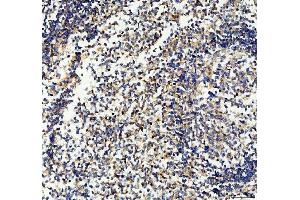 IHC analysis of CD33 using anti-CD33 antibody (ABIN4886523). (CD33 anticorps  (AA 18-259))