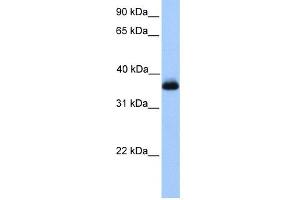 WB Suggested Anti-ERI2 Antibody Titration: 0. (ERI2 anticorps  (Middle Region))