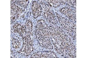 IHC analysis of Lamin A+C/LMNA using anti-Lamin A+C/LMNA antibody (ABIN7601843). (Lamin A/C anticorps  (AA 481-646))