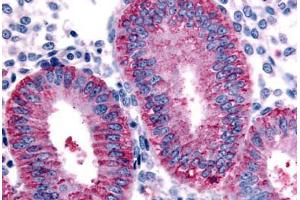 Human Uterus, Endometrium (formalin-fixed, paraffin-embedded) stained with DKK1 antibody ABIN213404 at 10 ug/ml followed by biotinylated goat anti-rabbit IgG secondary antibody ABIN481713, alkaline phosphatase-streptavidin and chromogen.