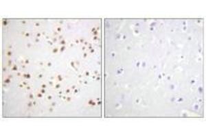 Immunohistochemistry analysis of paraffin-embedded human brain tissue using Catenin-δ1 (Ab-228) antibody. (CTNND1 anticorps  (Tyr228))