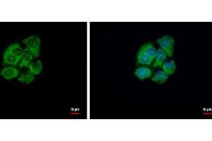ICC/IF Image GSTZ1 antibody [N1C3] detects GSTZ1 protein at cytoplasm by immunofluorescent analysis. (GSTZ1 anticorps)