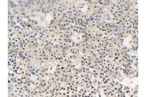 ABIN6256126 and ABIN6267667 at 1/100 staining human pituitary adenoma by IHC-P.