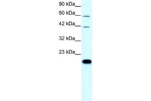 WB Suggested Anti-CLDN23 Antibody Titration:  0. (Claudin 23 anticorps  (C-Term))