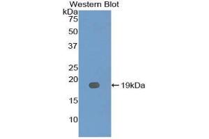 Western Blotting (WB) image for anti-Interleukin 12 Receptor, beta 2 (IL12RB2) (AA 285-441) antibody (ABIN3207280) (IL12RB2 anticorps  (AA 285-441))