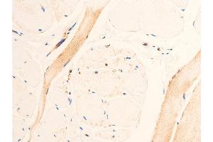 ABIN6267067 at 1/100 staining human heart tissue sections by IHC-P.