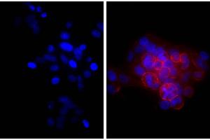 Human epithelial carcinoma cell line HEp-2 was stained with Mouse Anti-Human CD44-UNLB and DAPI. (Chèvre anti-Souris Ig (Heavy & Light Chain) Anticorps (TRITC))