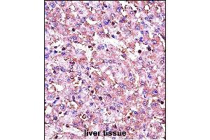 IGF1 Antibody (C-term) (ABIN658020 and ABIN2837861) immunohistochemistry analysis in formalin fixed and paraffin embedded human liver tissue followed by peroxidase conjugation of the secondary antibody and DAB staining. (IGF1 anticorps  (C-Term))