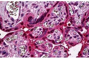 Human Placenta: Formalin-Fixed, Paraffin-Embedded (FFPE) (STAT5B anticorps  (AA 678-788))