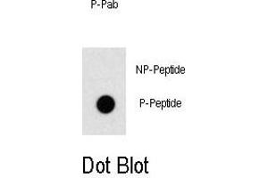 Dot blot analysis of anti-Phospho-OSR1-p Antibody Antibody (ABIN389959 and ABIN2839760) on nitrocellulose membrane. (OSR1 anticorps  (pThr310))