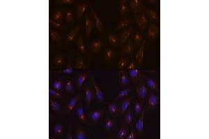 Immunofluorescence analysis of U-2 OS cells using Clathrin heavy chain Rabbit mAb (ABIN7266404) at dilution of 1:100 (40x lens).
