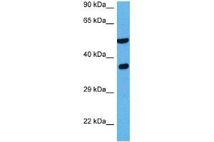 Host:  Rabbit  Target Name:  NDRG2  Sample Tissue:  Mouse Liver  Antibody Dilution:  1ug/ml (NDRG2 anticorps  (C-Term))