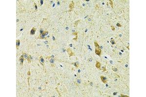 Immunohistochemistry of paraffin-embedded Mouse spinal cord using SLC25A11 Polyclonal Antibody at dilution of 1:100 (40x lens).