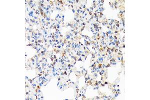 Immunohistochemistry of paraffin-embedded rat lung using TIRAP Rabbit mAb (ABIN7270842) at dilution of 1:100 (40x lens). (TIRAP anticorps)