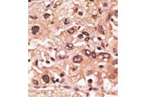 Image no. 2 for anti-Melanoma Antigen Family F, 1 (MAGEF1) (C-Term) antibody (ABIN358660) (MAGEF1 anticorps  (C-Term))