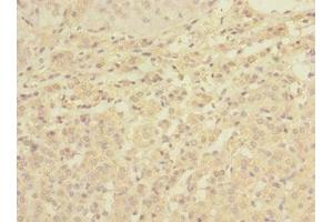 Immunohistochemistry of paraffin-embedded human adrenal gland tissue using ABIN7174780 at dilution of 1:100 (C1ORF127 anticorps  (AA 401-648))