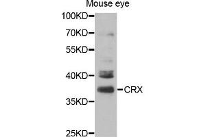 Western blot analysis of extracts of Mouse eye cell line, using CRX antibody. (CRX anticorps)