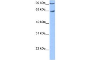 Western Blotting (WB) image for anti-Zinc Finger Protein 449 (ZNF449) antibody (ABIN2460405) (ZNF449 anticorps)