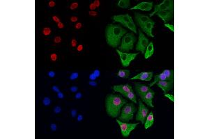 ABIN6263417 and ABIN6272965 staining Hela cells by IF/ICC. (MTA3 anticorps  (Internal Region))