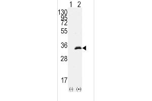 Western blot analysis of CDK1(arrow) using rabbit polyclonal CDK1 Antibody (T14) (ABIN391744 and ABIN2841621). (CDK1 anticorps  (AA 1-30))
