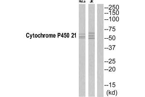 Western Blotting (WB) image for anti-Cytochrome P450, Family 21, Subfamily A, Polypeptide 2 (CYP21A2) (C-Term) antibody (ABIN1852650) (CYP21A2 anticorps  (C-Term))