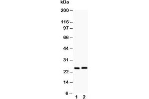 Western blot testing of Claudin 2 antibody and Lane 1:  rat kidney;  2: rat liver (Claudin 2 anticorps  (AA 38-230))