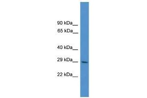 Human THP-1; WB Suggested Anti-ZNF688 Antibody Titration: 0.