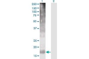 Western Blot analysis of TM4SF4 expression in transfected 293T cell line by TM4SF4 monoclonal antibody (M03), clone 4E6.