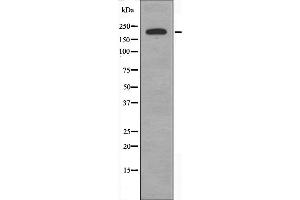 Western blot analysis of extracts from COLO cells, using BCOR antibody. (BCOR anticorps  (Internal Region))