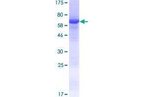 Image no. 1 for Chromosome 15 Open Reading Frame 58 (C15orf58) (AA 1-385) protein (GST tag) (ABIN1347183)
