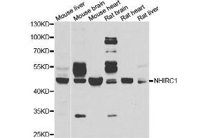 Western blot analysis of extracts of various cell lines, using NHLRC1 antibody. (NHLRC1 anticorps)