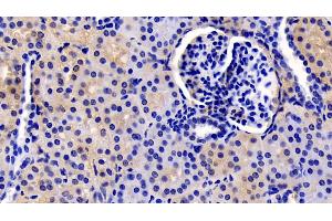 Detection of TSLP in Human Kidney Tissue using Monoclonal Antibody to Thymic Stromal Lymphopoietin (TSLP) (Thymic Stromal Lymphopoietin anticorps  (AA 29-159))