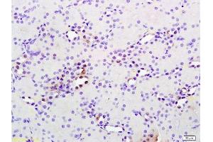 Formalin-fixed and paraffin embedded rat kidney tissue labeled with Anti phospho-MAP3K9+MAP3K10(Thr312+Thr266) Polyclonal Antibody, Unconjugated  at 1:200 followed by conjugation to the secondary antibody and DAB staining (MAP3K9 anticorps  (pThr312))