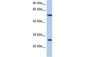 WB Suggested Anti-ZNF10 Antibody Titration:  0. (ZNF10 anticorps  (N-Term))