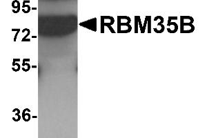 Western blot analysis of RBM35B in human lung tissue lysate with RBM35B antibody at 1 µg/mL. (ESRP2 anticorps  (C-Term))