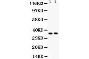 Anti- FRZB Picoband antibody, Western blotting All lanes: Anti FRZB  at 0. (FRZB anticorps  (AA 176-325))