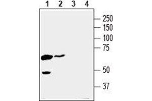 Western blot analysis of human K562 chronic myelogenous leukemia cell line lysate (lanes 1 and 3) and human MDA-MB-231 breast adenocarcinoma cell line lysate (lanes 2 and 4): - 1,2. (SLC16A3 anticorps  (C-Term, Intracellular))
