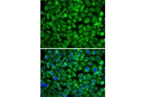 Immunofluorescence analysis of A-549 cells using S antibody .
