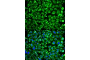 Immunofluorescence analysis of A-549 cells using S antibody . (SAT2 anticorps  (AA 1-170))