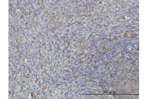 Immunoperoxidase of monoclonal antibody to MARCKS on formalin-fixed paraffin-embedded human spleen.
