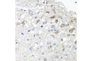 Immunohistochemistry of paraffin-embedded rat brain using METTL20 antibody at dilution of 1:100 (x40 lens).