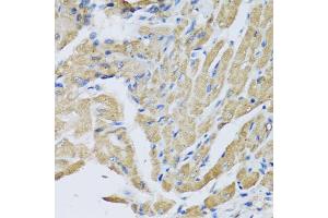 Immunohistochemistry of paraffin-embedded mouse heart using CRHBP antibody (ABIN5973945) at dilution of 1/100 (40x lens). (CRHBP anticorps)
