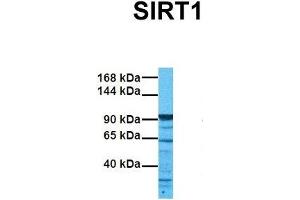 Host:  Rabbit  Target Name:  SIRT1  Sample Tissue:  Human 786-0  Antibody Dilution:  1. (SIRT1 anticorps  (N-Term))