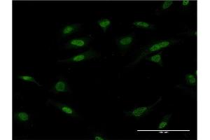 Immunofluorescence of monoclonal antibody to ATF2 on HeLa cell. (ATF2 anticorps  (AA 241-340))