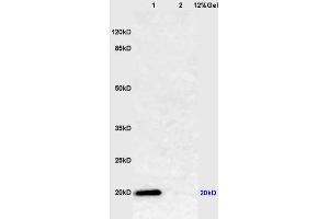 Lane 1: mouse lung lysates Lane 2: mouse muscle lysates probed with Anti Caveolin-1 Polyclonal Antibody, Unconjugated (ABIN686752) at 1:200 in 4 °C. (Caveolin-1 anticorps  (AA 2-120))