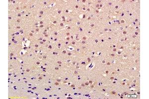 Formalin-fixed and paraffin embedded rat brain labeled with Anti-Thrap3/TRAP150 Polyclonal Antibody, Unconjugated  at 1:200 followed by conjugation to the secondary antibody and DAB staining (THRAP3 anticorps  (AA 631-730))