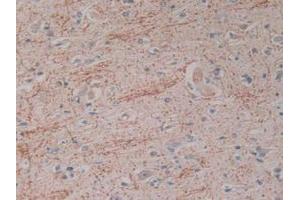 Figure. (Kallikrein 2 anticorps  (AA 19-261))