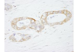 Immunohistochemistry (IHC) image for anti-Ubiquitin Specific Peptidase 3 (USP3) (AA 471-521) antibody (ABIN7449030) (USP3 anticorps  (AA 471-521))
