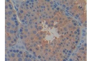 Detection of PDK2 in Mouse Testis Tissue using Polyclonal Antibody to Pyruvate Dehydrogenase Kinase Isozyme 2 (PDK2)