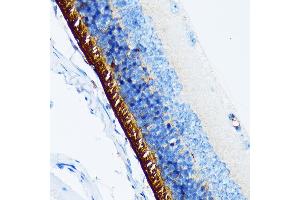 Immunohistochemistry of paraffin-embedded mouse retina using Rhodopsin Rabbit mAb (ABIN7269974) at dilution of 1:100 (40x lens). (Rho-related GTP-binding protein anticorps)